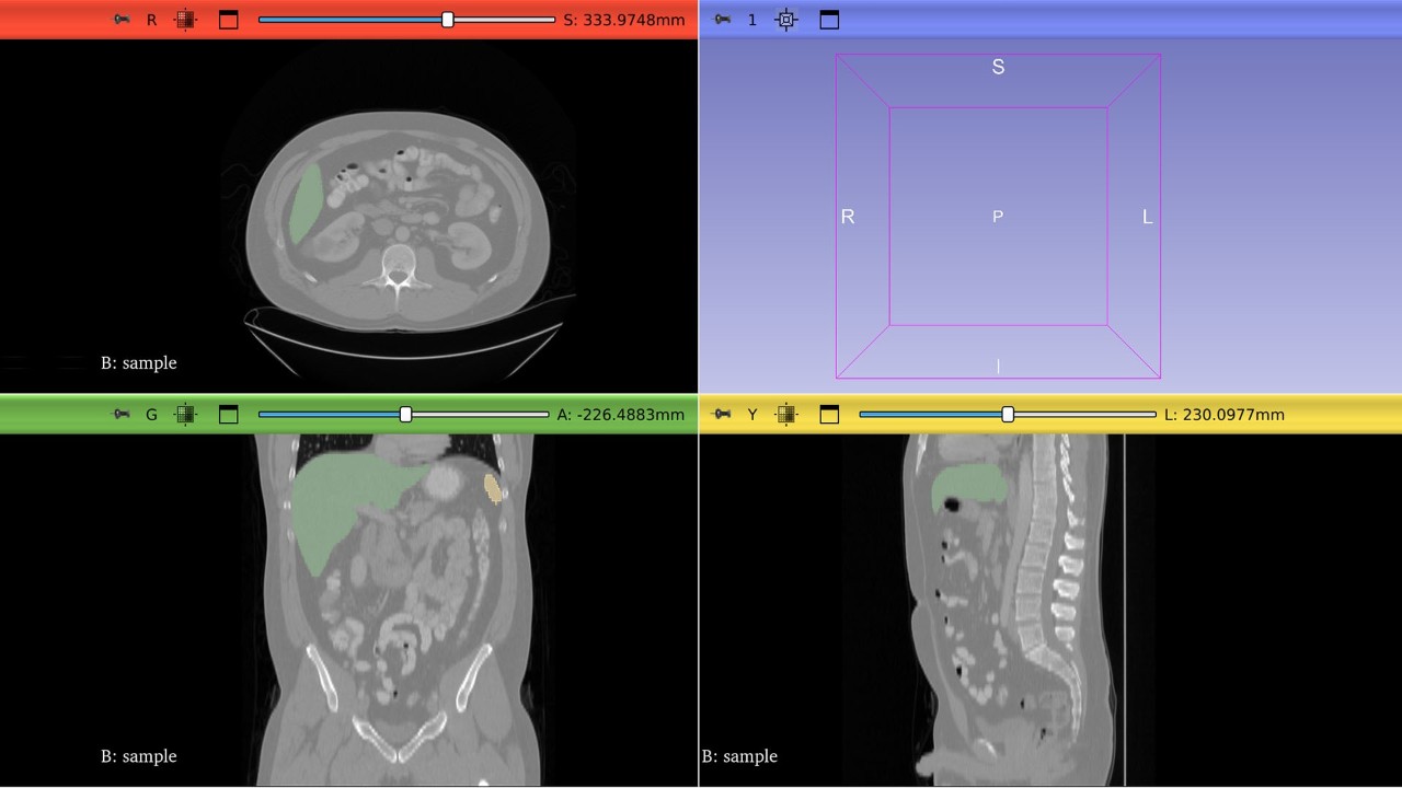 Holoscan Reference Apps